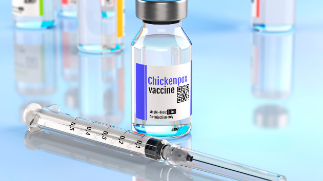 More than 90% of chickenpox cases in New York City outbreak among unvaccinated people